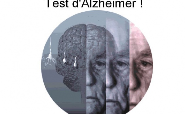 Test d'Alzheimer