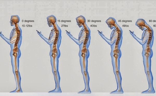 TMS, douleurs cervicales, tendinites… évitez que vos smartphones ne vous détruisent physiquement